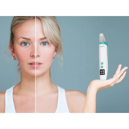 Beper - Limpador de poros recarregável USB/5V 400 mAh